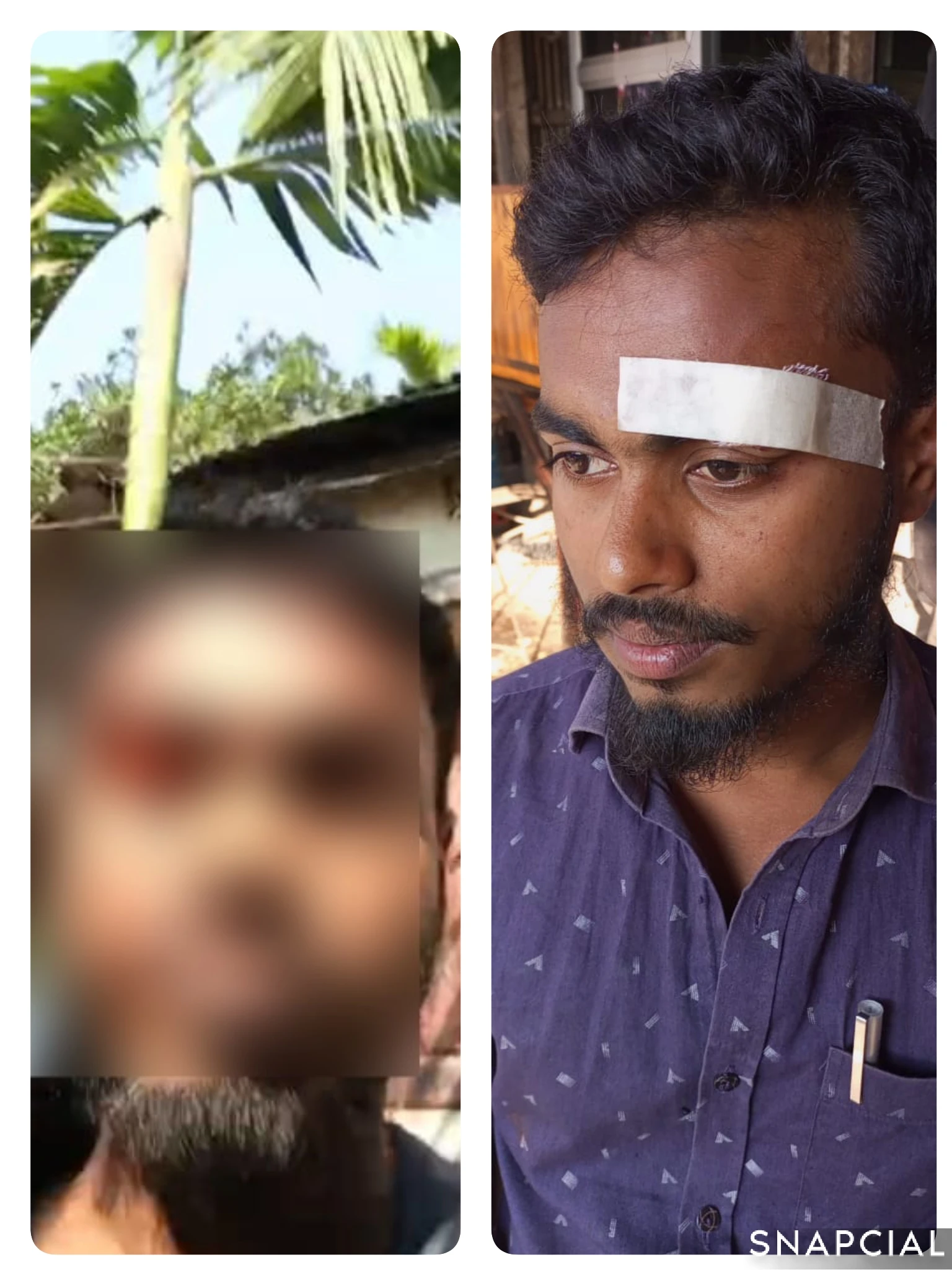 সাংবাদিকতার কণ্ঠ রোধে সন্ত্রাসী হামলা, আহত দুই গণমাধ্যমকর্মী