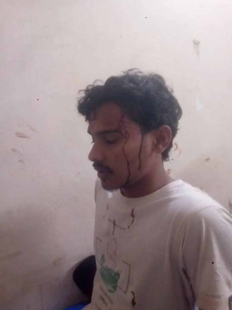 দাওয়াতের আড়ালে হামলা, অভিযোগ বিএনপি নেতার বিরুদ্ধে